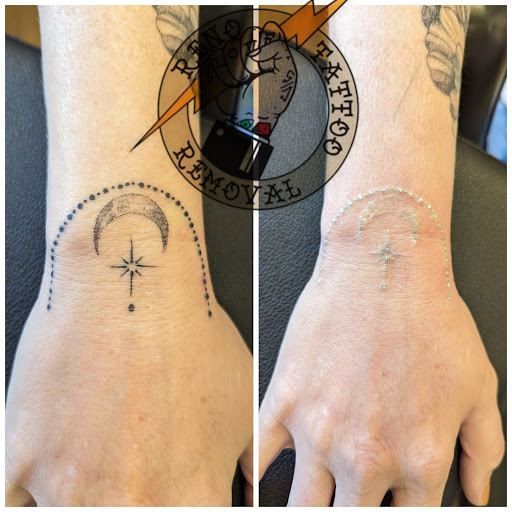 Find tattoo ideas for woman on leg for your next unique tattoo in Reno at Reno Tattoo Removal