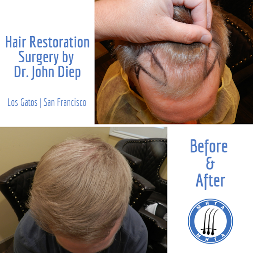 Hair Replacement Service «Medical Hair Transplant & Aesthetics», reviews and photos, 490 Post St #1701, San Francisco, CA 94102, USA