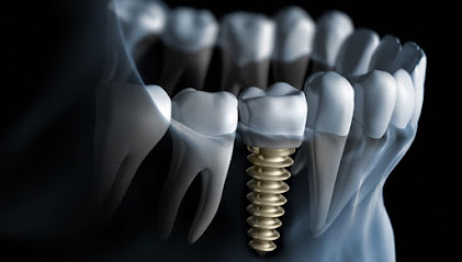 Klinik Dental Implant Jakarta