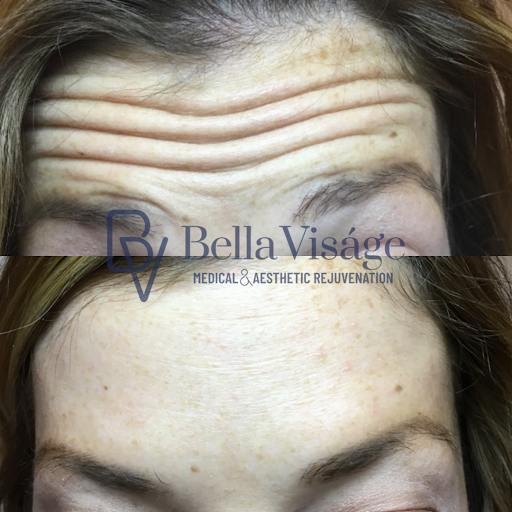 Explore letter g tattoo ideas, creative tattoo ideas in Lakeland, available at Bella Visge Medical & Aesthetic Rejuvenation