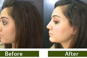 Botox in Islamabad Pakistan | Botox and Fillers image