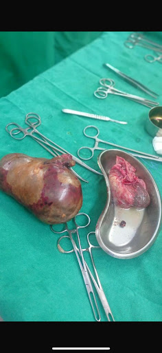 Dr Smita Ghatak | Top Gynaecologist | Best Gynecologist in Saltlake | Best lady gynaecologist in kolkata