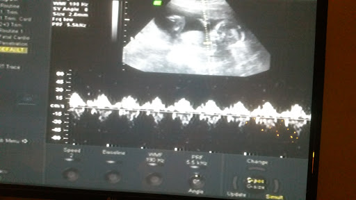 Baby Store «Ideal Baby & Kids - Hialeah», reviews and photos, 1170 W 49th St, Hialeah, FL 33012, USA