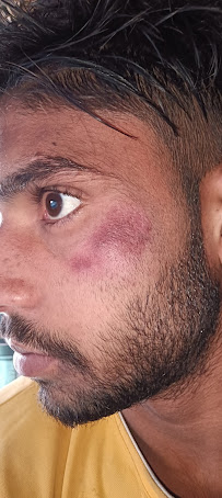 The facial experience - Photo 6 - Car repair in Morrisville, NC, Cary