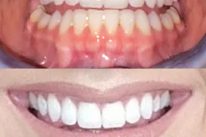 Perfect Smile Dental - Wallasey image