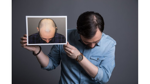 Hair Transplantation Clinic «Bosley Medical - Long Island», reviews and photos, 324 S Service Rd Suite 122, Melville, NY 11747, USA