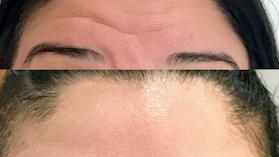 Dra Simone Scalabrin -Cirurgiã-Dentista/ Endodontista/Esthetic Aligner