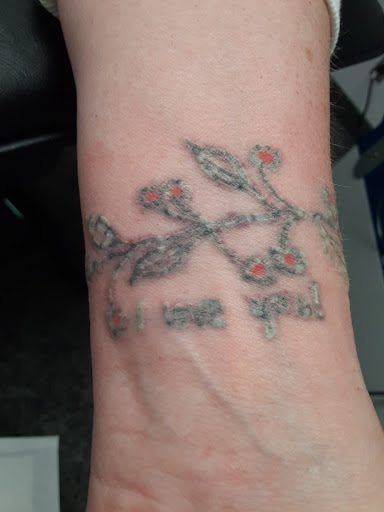 Explore large tattoo ideas, creative tattoo ideas in Saint Paul, available at Fearless Tattoo Removal