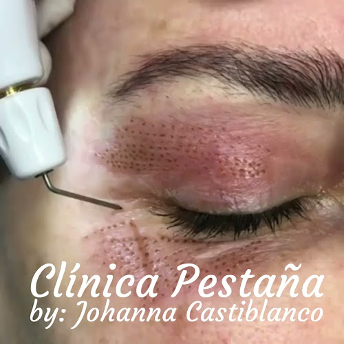 Comentários e avaliações sobre o Clínica Pestaña by Johanna Castiblanco