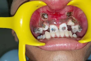 𝗗𝗿 𝗔𝗻𝗶𝗹 𝗬𝗮𝗱𝗮𝘃 𝗗𝗲𝗻𝘁𝗮𝗹 𝗛𝗼𝘀𝗽𝗶𝘁𝗮𝗹 : Best Dentist / Dental clinic / Dental Implant Centre.in Rewari image