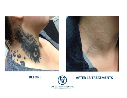 Explore tramp stamp tattoo ideas, creative tattoo ideas in San Diego, available at Removery Tattoo Removal & Fading