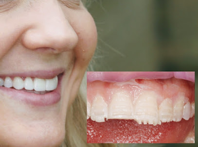 Precision Cosmetic Dentistry & Digital Dentures