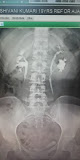 Patna Digital X Ray And Ultrasound