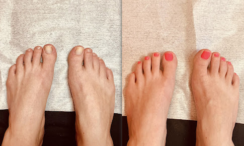 Simply Skin at Tamzyn - Simply Skin at Tamzyn