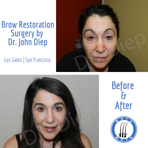 Hair Replacement Service «Medical Hair Transplants & Aesthetics», reviews and photos, 15055 Los Gatos Blvd Suite #110, Los Gatos, CA 95032, USA