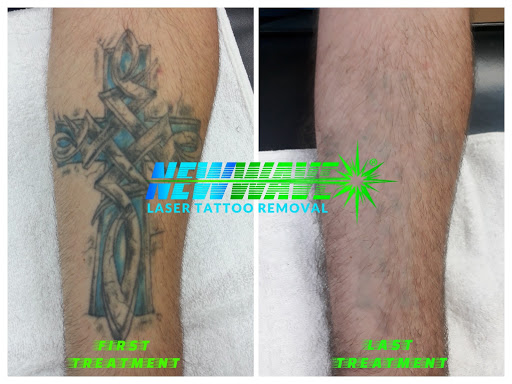 Explore sacred geometry tattoo ideas, creative tattoo ideas in Bethlehem, available at New Wave Laser Tattoo Removal