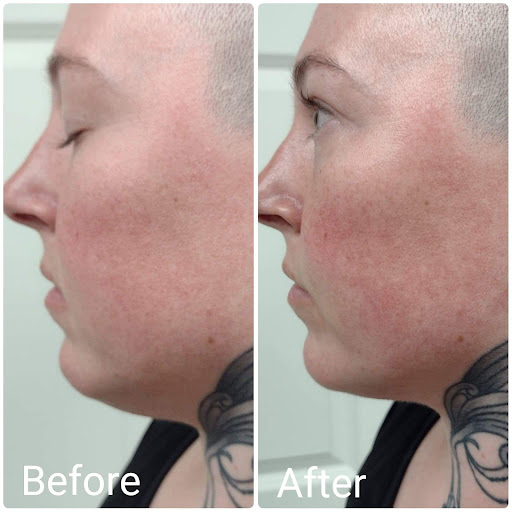 Explore metamorphosis tattoo ideas, creative tattoo ideas in Brighton, available at Tip of the Spear Laser Esthetics