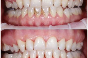 Стоматологія Рава-Руська / OH Esthetic Dentistry / Omeliash & Husak / Омеляш та Гусак / Stomatologia image