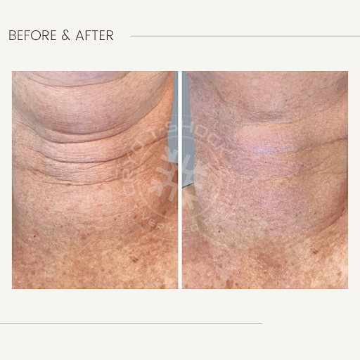 Explore incubus tattoo ideas, creative tattoo ideas in Arlington, available at Haven Studio Co. (formerly Ink Haven Studio)