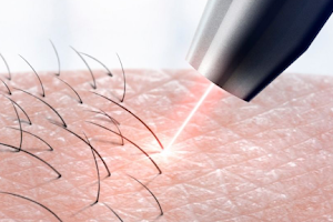 Metro Laser Clinic image