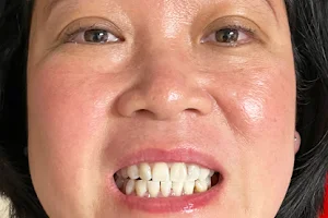 The Brite Lab Teeth Whitening image