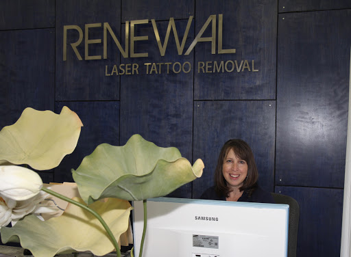 Explore cattle brand tattoo ideas, creative tattoo ideas in Lake Worth, available at Renewal Laser Tattoo Removal
