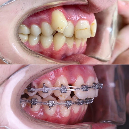 SDC1st Dentist (ศาลาแดง ซ.1 ทันตกรรม)