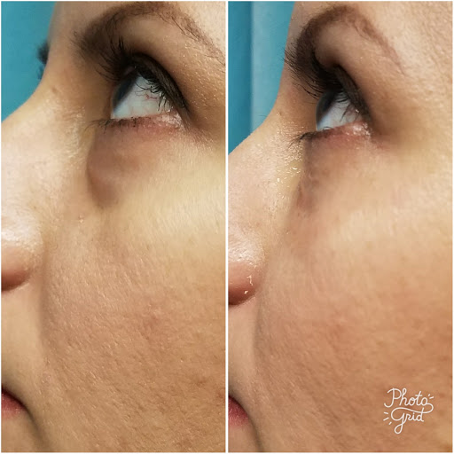 Medical Spa «Premier Med Spa & Weight Loss», reviews and photos, 2001 N Collins Blvd #105, Richardson, TX 75080, USA