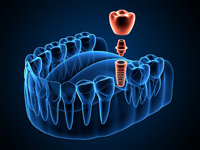 Dental Implants of Ocala