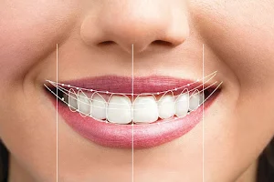 Dental Hub Orthodontic & Implant Centre for Invisalign / Braces / Dental Implants / RCT . Best Dental Clinic In Jaipur image