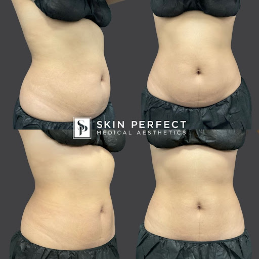 Explore tattoo rings ideas, creative tattoo ideas in Whittier, available at Skin Perfect Medical Aesthetics