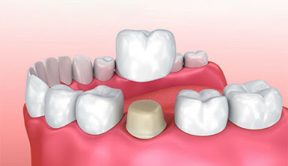Novacare Dental - Langley