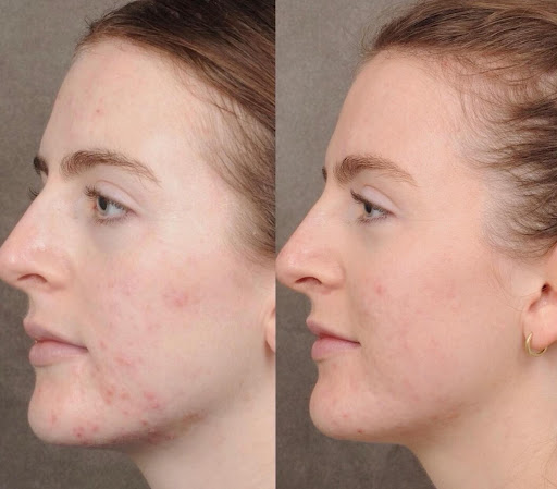 Explore icarus tattoo ideas, creative tattoo ideas in Princeton Junction, available at Princeton Aesthetics