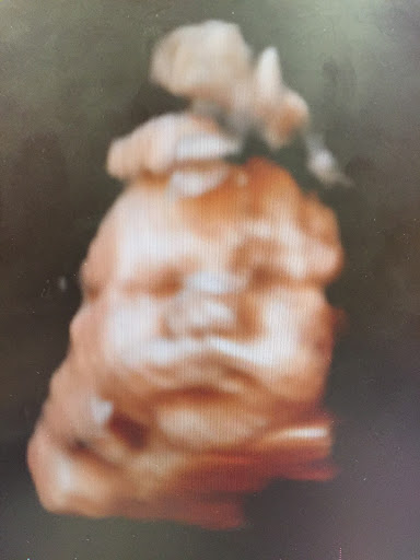 Medical Diagnostic Imaging Center «My little baby 4d & boutique», reviews and photos, 8930 TX-121, McKinney, TX 75070, USA