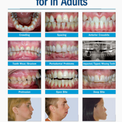 Teeth & Braces: Super Speciality Dental Care - Teeth & Braces: Super Speciality Dental Care
