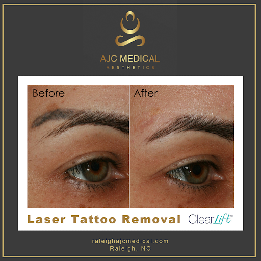 Explore nature tattoo ideas for guys, creative tattoo ideas in Raleigh, available at AJC Medical Aesthetics