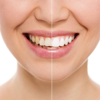 DClieporiai | Odontologijos klinika Šiauliuose | Odontologai Šiauliuose | Dantų protezavimas | Dantų implantai | Balinimas