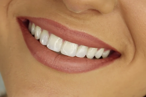 Seb Northern Beaches Dental and Implants image