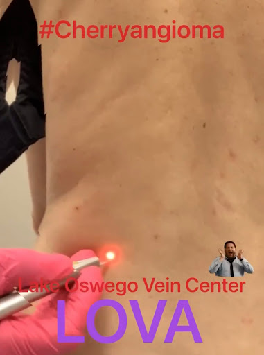 Explore tattoo ideas for shoulder and arm, creative tattoo ideas in Lake Oswego, available at Lake Oswego Vein and Aesthetic LOVA