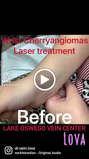 Explore sailor moon tattoo ideas, creative tattoo ideas in Lake Oswego, available at Lake Oswego Vein and Aesthetic LOVA