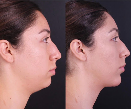 Dr. Gould Plastic Surgery image