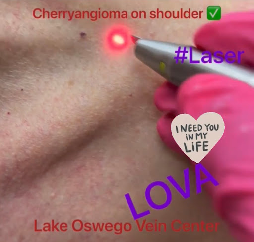 Explore mustard seed tattoo ideas, creative tattoo ideas in Lake Oswego, available at Lake Oswego Vein and Aesthetic LOVA