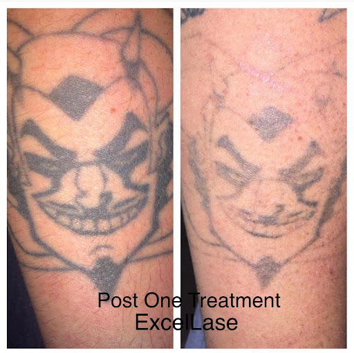 Explore family sleeve tattoo ideas, creative tattoo ideas in Raleigh, available at ExcelLase