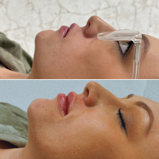 Explore leo tattoo ideas for women, creative tattoo ideas in Owensboro, available at The Skin Lab