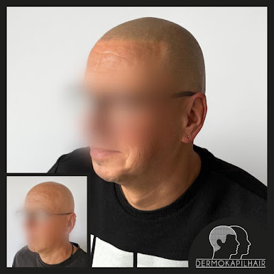 Dermokapilhair à Lorient