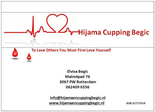 Hijama en Cupping Begic