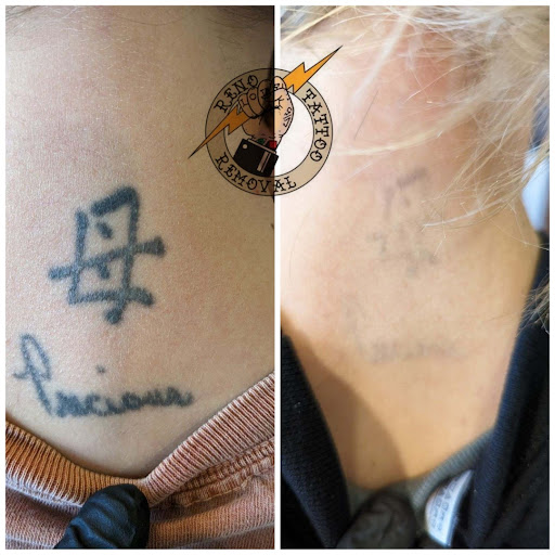 Explore matching mother daughter tattoos ideas, creative tattoo ideas in Reno, available at Reno Tattoo Removal