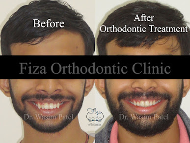 Fiza Orthodontic Clinic - Fiza Orthodontic Clinic