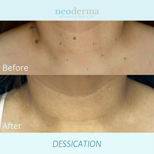 Explore daisy flower tattoo ideas, creative tattoo ideas in Anaheim, available at Neoderma