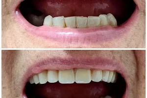 Dentista Dr. Paulo Rogerio Cardoso de Souza ortodontista e implantes em Pindamonhangaba image